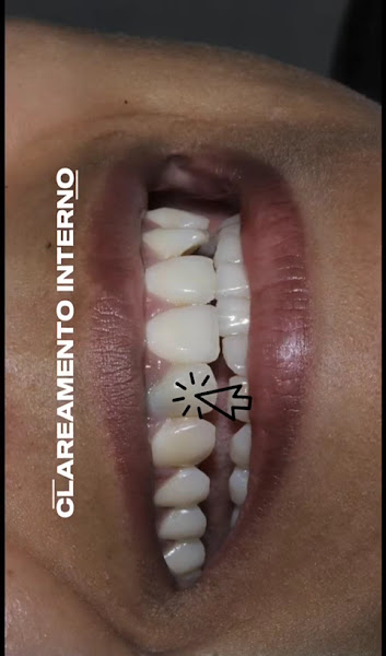 Foto 4 de Dra Fernanda Maranhão | Dentista em Porto Velho