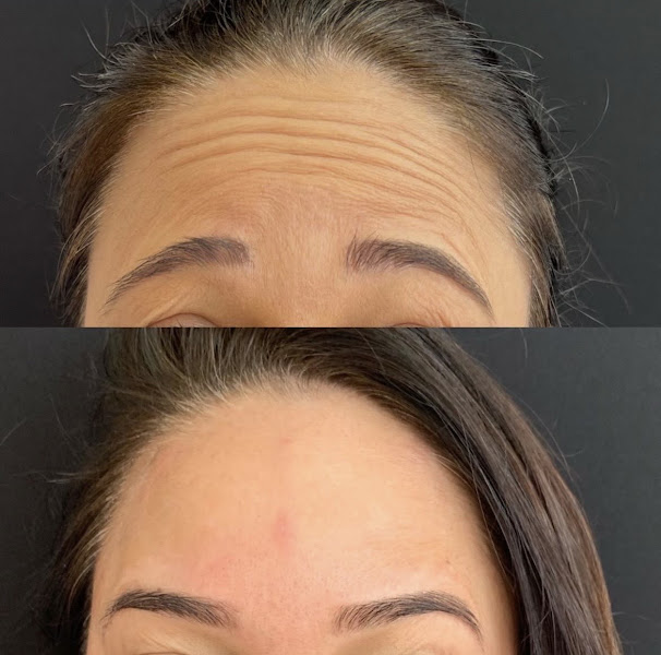 Foto 2 de Dra Fernanda Marques - Odontologia e Harmonização facial