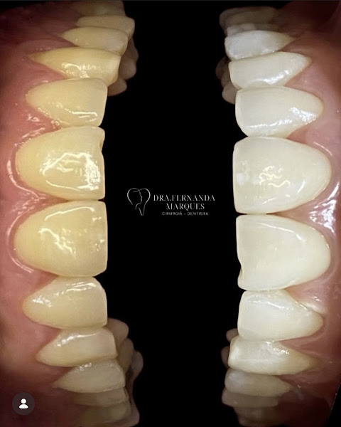 Foto 3 de Dra Fernanda Marques - Odontologia e Harmonização facial