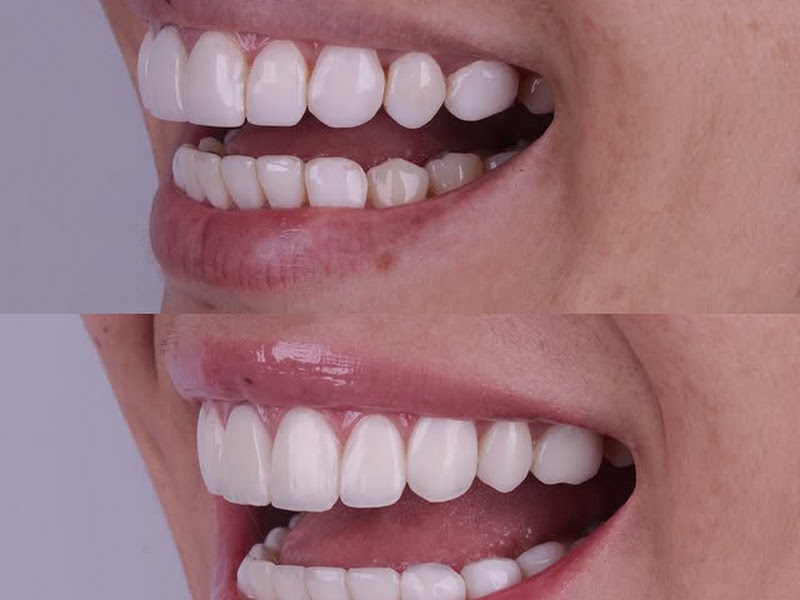 Foto 3 de Dra. Fernanda Neves Souza - Cirurgiã Dentista