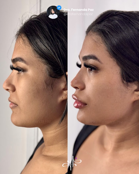 Foto 2 de Dra. Fernanda Paz | Clínica de Estética Avançada | Harmonização Facial | Emagrecimento