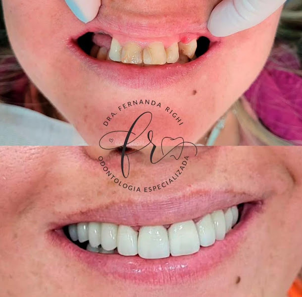 Foto 2 de Dra Fernanda Righi Odontologia Especializada