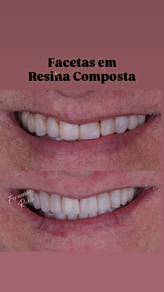 Foto 3 de Dra Fernanda Rubio - Facetas, Lentes e Harmonização Facial