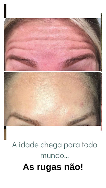 Foto 3 de Dra Fernanda Silveira Harmonização Facial