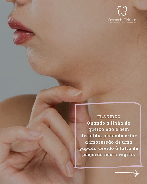 Foto 3 de Dra. Fernanda Thiesen | Extração de Siso São Leopoldo | Implante Dentário