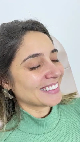 Foto 3 de Dra. Fiorella Escobar - Especialista em Harmonização Facial