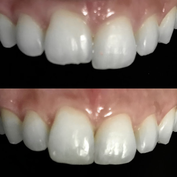 Foto 3 de Dra. Flávia Alcântara - Cirurgia oral menor e implantes