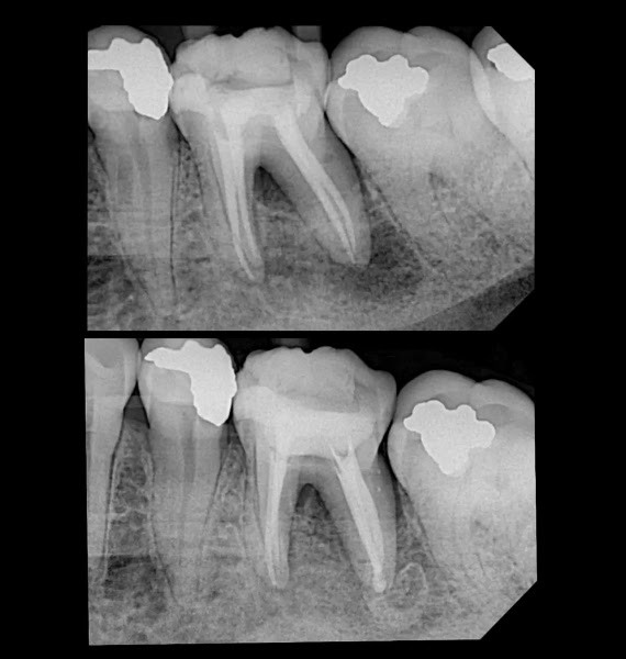 Foto 3 de Dra Flavia Plazza Endodontia | Tratamento de Canal | São José do Rio Preto