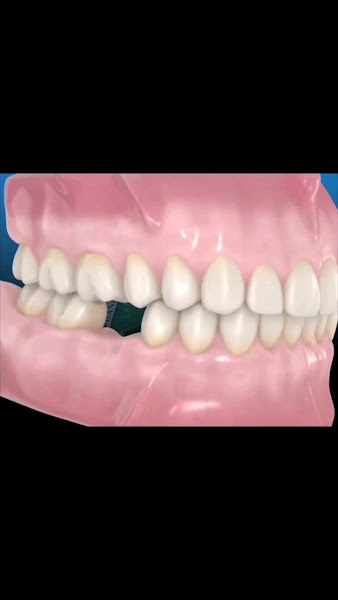 Foto 3 de Dra. Fran Martins - Dentista - Periodontia