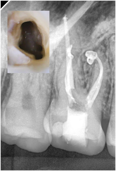 Foto 3 de Dra. Francielle A. | Endodontia | Endodontista | Tratamento de canal BH | Dentista BH
