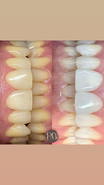 Foto 2 de Dra. Francielle Moraes - Cirurgiã Dentista - São Caetano do Sul