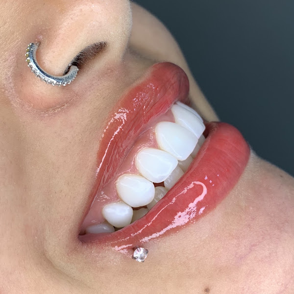 Foto 3 de Dra Francielle Terrinha | Faceta | Implantodontia | Endodontista | Estética Piracicaba