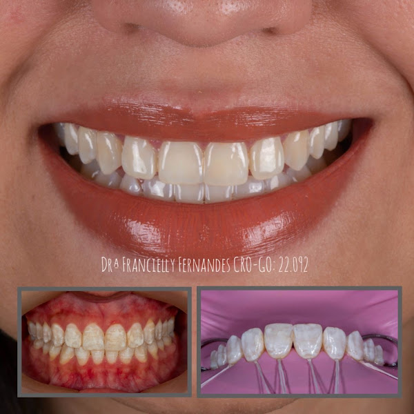 Foto 2 de Dra Francielly Fernandes