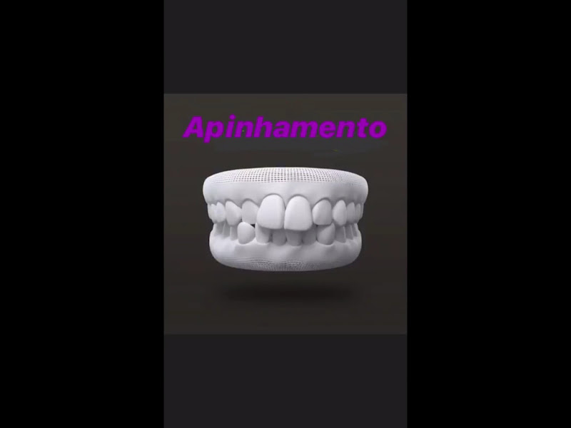 Foto 3 de Dra Franciene Amorim Ortodontista Recife