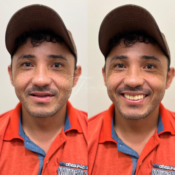 Foto 3 de Dra Francilania Rodrigues | Estética Oral