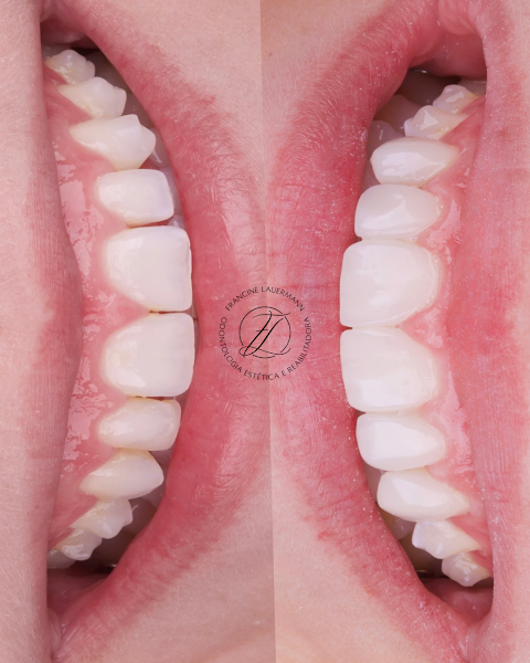 Foto 2 de Dra Francine Lauermann - Dentista