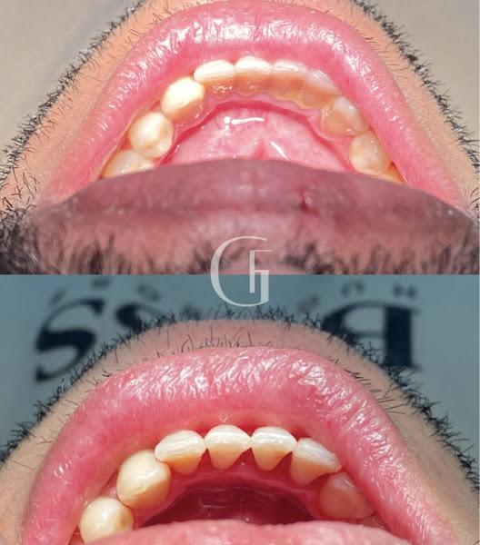 Foto 2 de Dra. Gabriela Ferreira | Harmonização Facial em Campo Grande