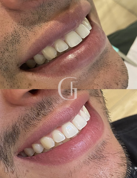 Foto 3 de Dra. Gabriela Ferreira | Harmonização Facial em Campo Grande