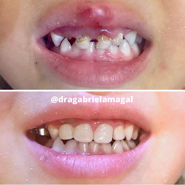 Foto 2 de Dra Gabriela Magalhães Odontopediatra