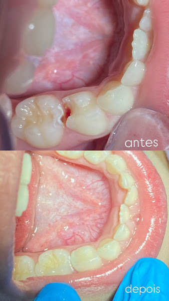 Foto 3 de Dra. Gabriela Moraes - Odontopediatria