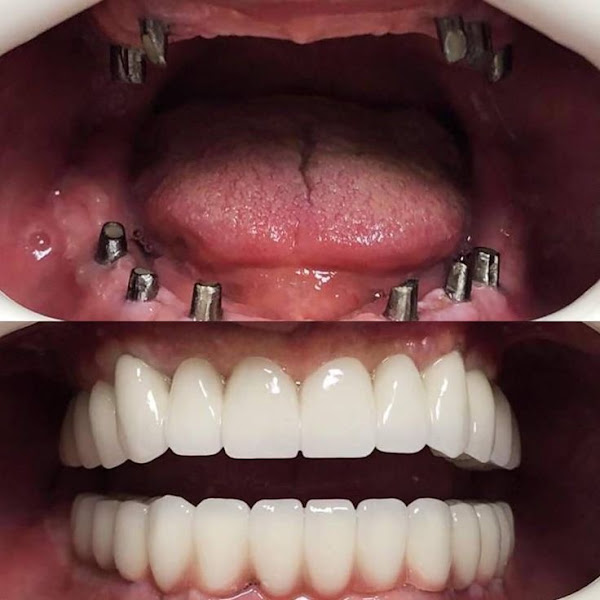 Foto 3 de Dra. Gabriela Richetto | Cirurgiã-Dentista