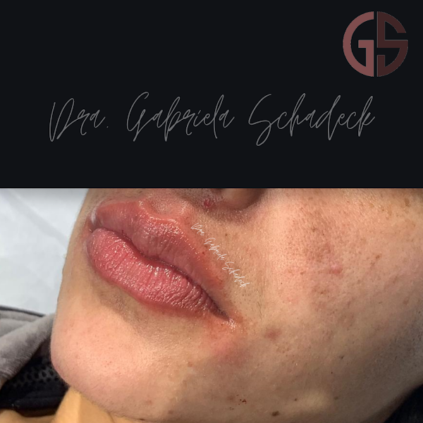 Foto 3 de Dra. Gabriela Schadeck | Consultório odontológico em Guarapuava