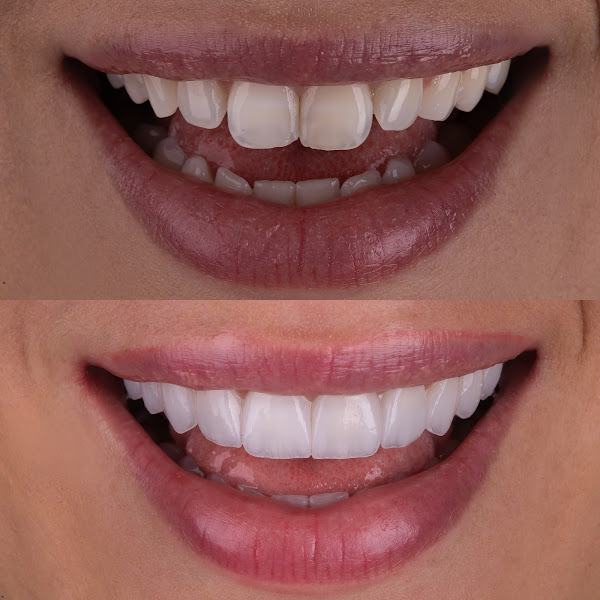 Foto 2 de Dra. Gabriela Temperani e Dr. Gustavo Carvalho - Odontologia estética