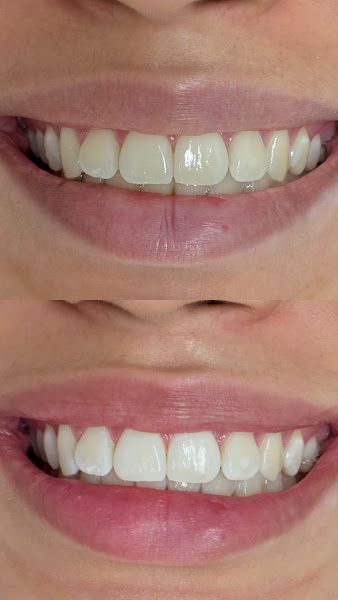 Foto 3 de Dra. Gabriela Veigantt | Dentista 24h | Urgência e emergencia