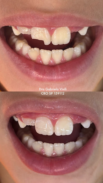 Foto 2 de Dra. Gabriela Vivili | Dentista | Odontologia