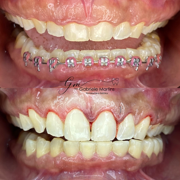 Foto 3 de Dra. Gabriele Martins Periodontista/ Laserterapia Barra da Tijuca.