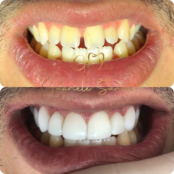 Foto 2 de Dra. Gabriele Santos | Dentista