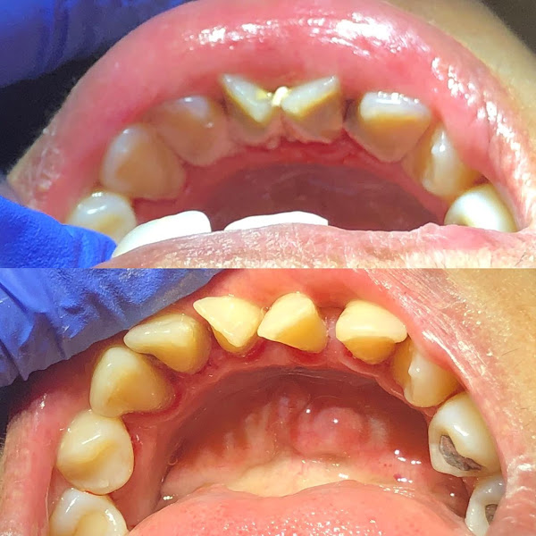 Foto 3 de Dra. Gabriele Santos | Dentista