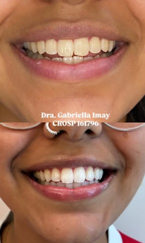 Foto 3 de Dra. Gabriella Imay - Odontologia & Estética