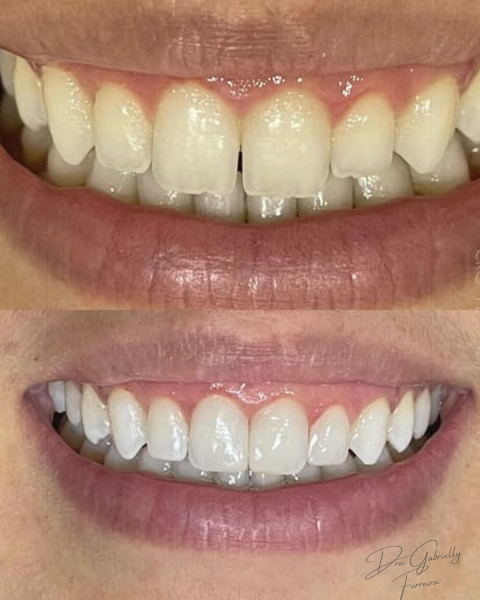 Foto 3 de Dra Gabrielly Ferreira