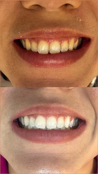 Foto 2 de Dra. Gabrielly Ramos | Dentista