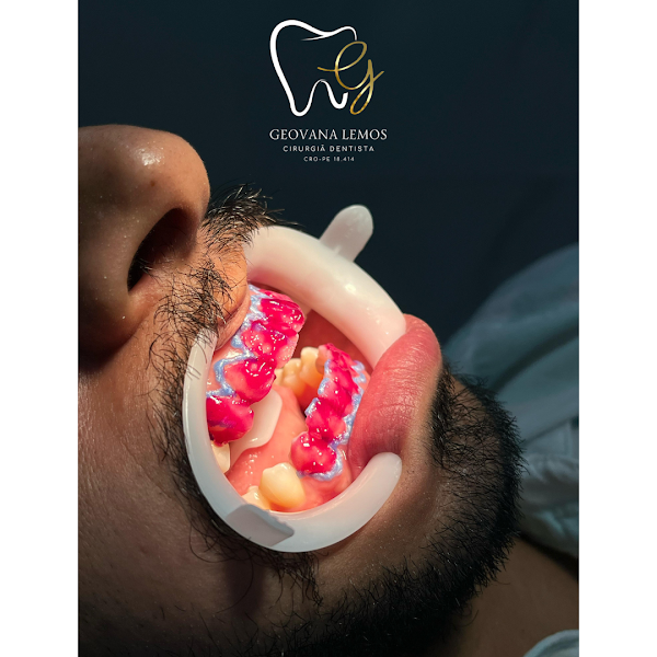 Foto 2 de Dra. Geovana Lemos | Dentista em Olinda | Clareamento Dental