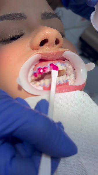 Foto 3 de Dra. Geovana Lemos | Dentista em Recife | Clareamento Dental