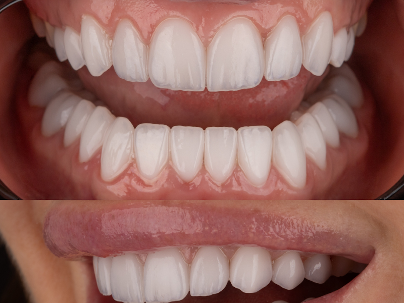 Foto 3 de Dra Geovana Mofato - Mofato Odontologia | Invisalign doctor