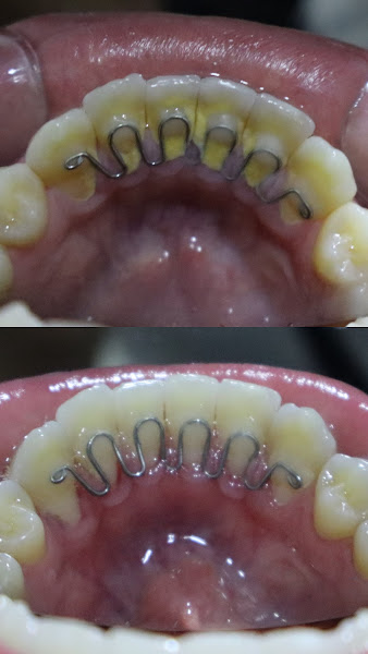 Foto 3 de Dra. Geovana Seabra | Cirurgiã-dentista
