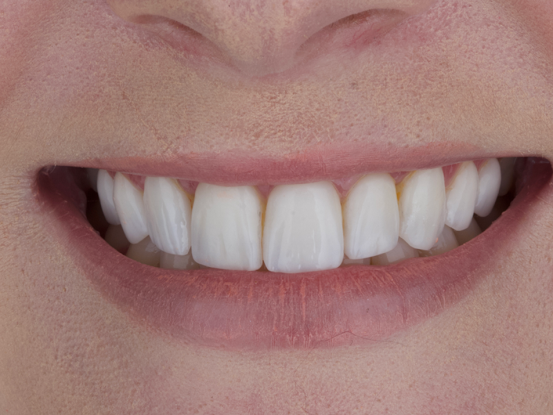 Foto 3 de Dra. Gilcileide Correia | Itaim Paulista - SP