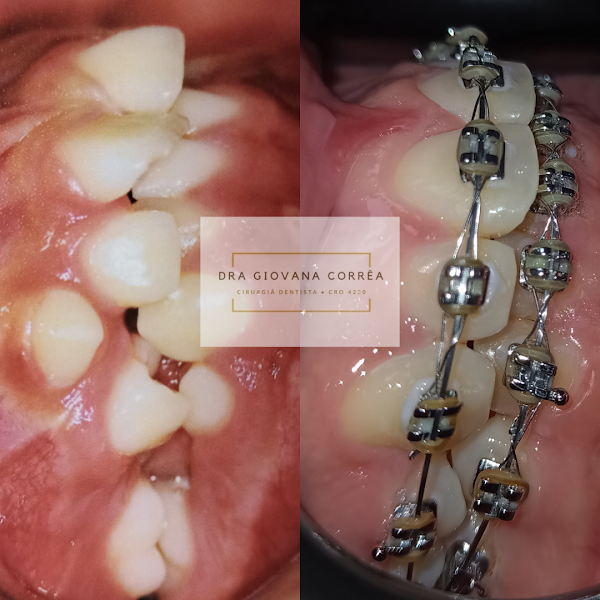 Foto 3 de Dra. Giovana Corrêa - Cirurgiã Dentista - WORK