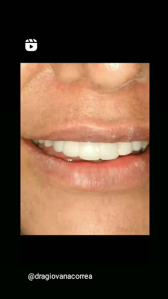 Foto 4 de Dra. Giovana Corrêa - Cirurgiã Dentista - WORK