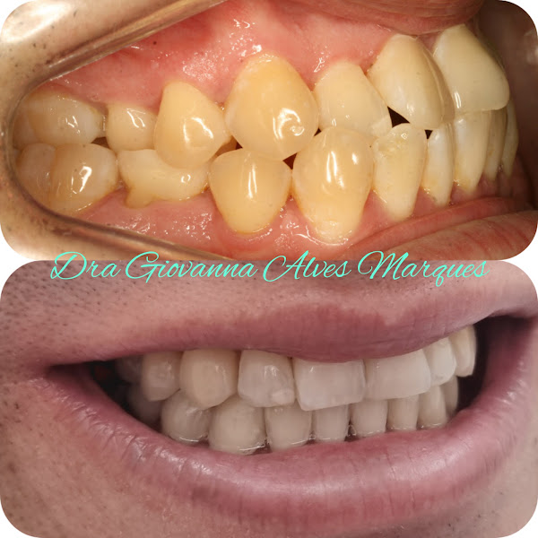 Foto 2 de Dra. Giovanna Alves | Dentista Ortodontista