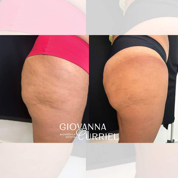 Foto 3 de Dra. Giovanna Curriel - Harmonização e Estética em Bauru