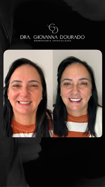Foto 2 de Dra Giovanna Dourado Odontologia Especializada