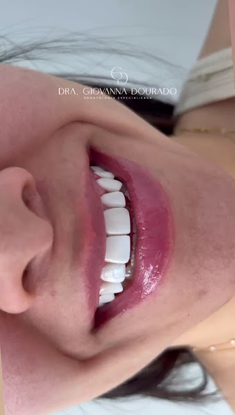 Foto 4 de Dra Giovanna Dourado Odontologia Especializada