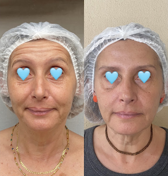 Foto 2 de Dra. Giovanna Nelli Zaratine | Odontopediatra em Bauru