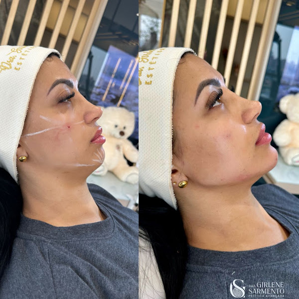 Foto 3 de Dra. Girlene Sarmento | Estética Avançada