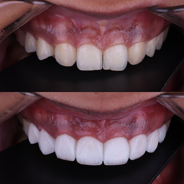 Foto 2 de Dra. Gisela Marins Odontologia e Estética