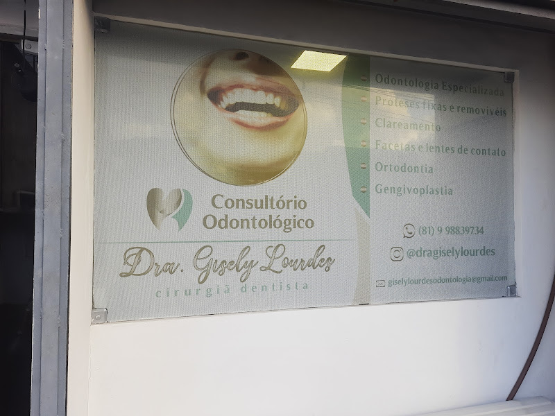 Foto 3 de Dra. Gisely Lourdes | Facetas em Resina em Recife